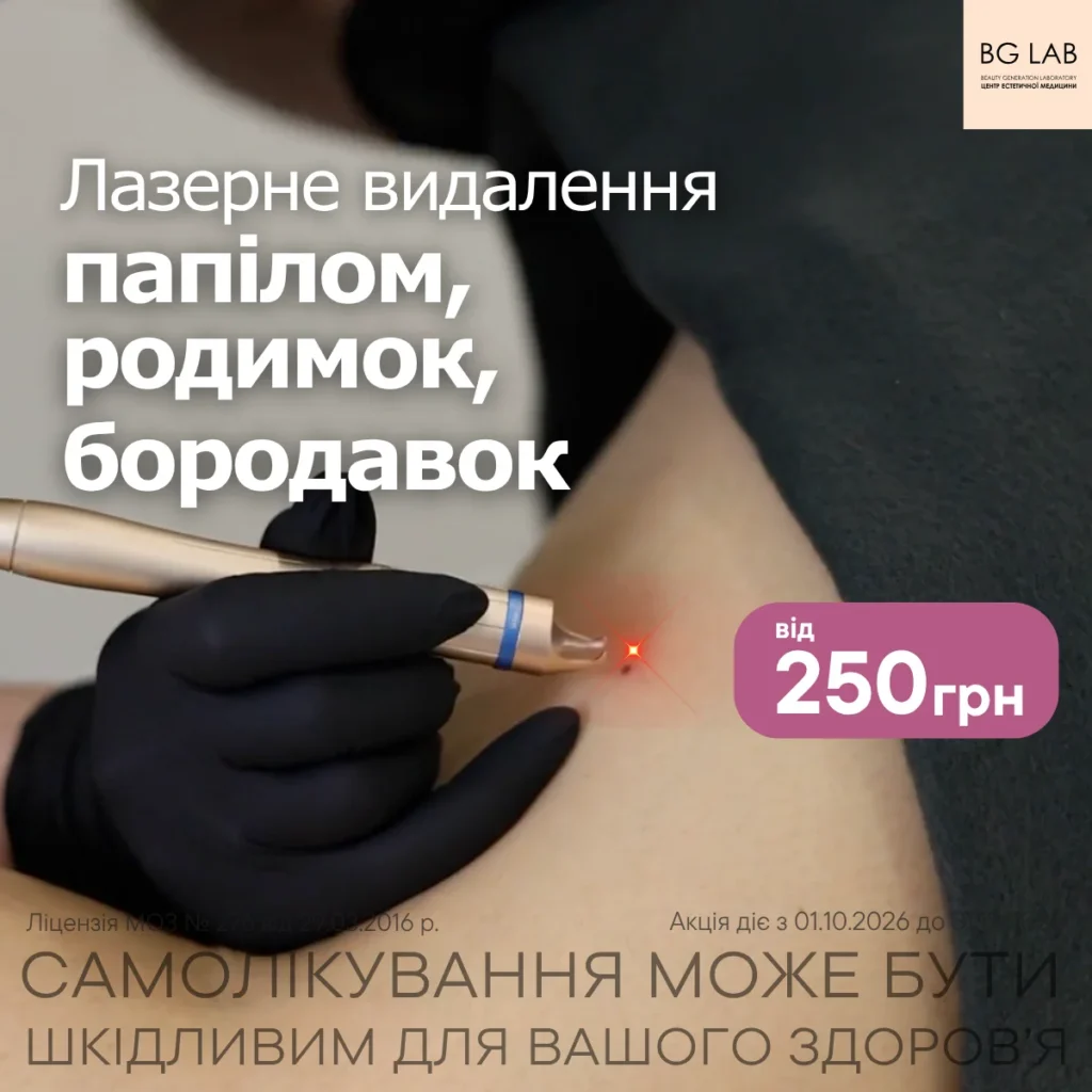 Лазерне видалення папілом, родимок, бородавок від 250 грн