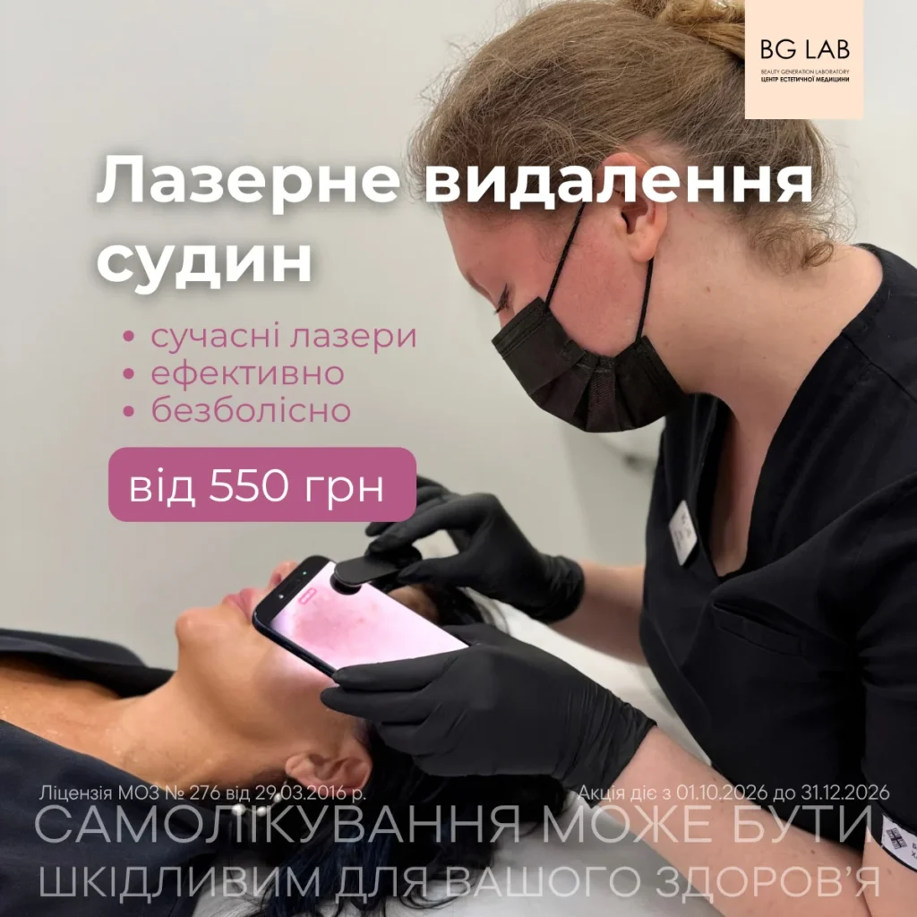Лазерне видалення судин від 550 грн