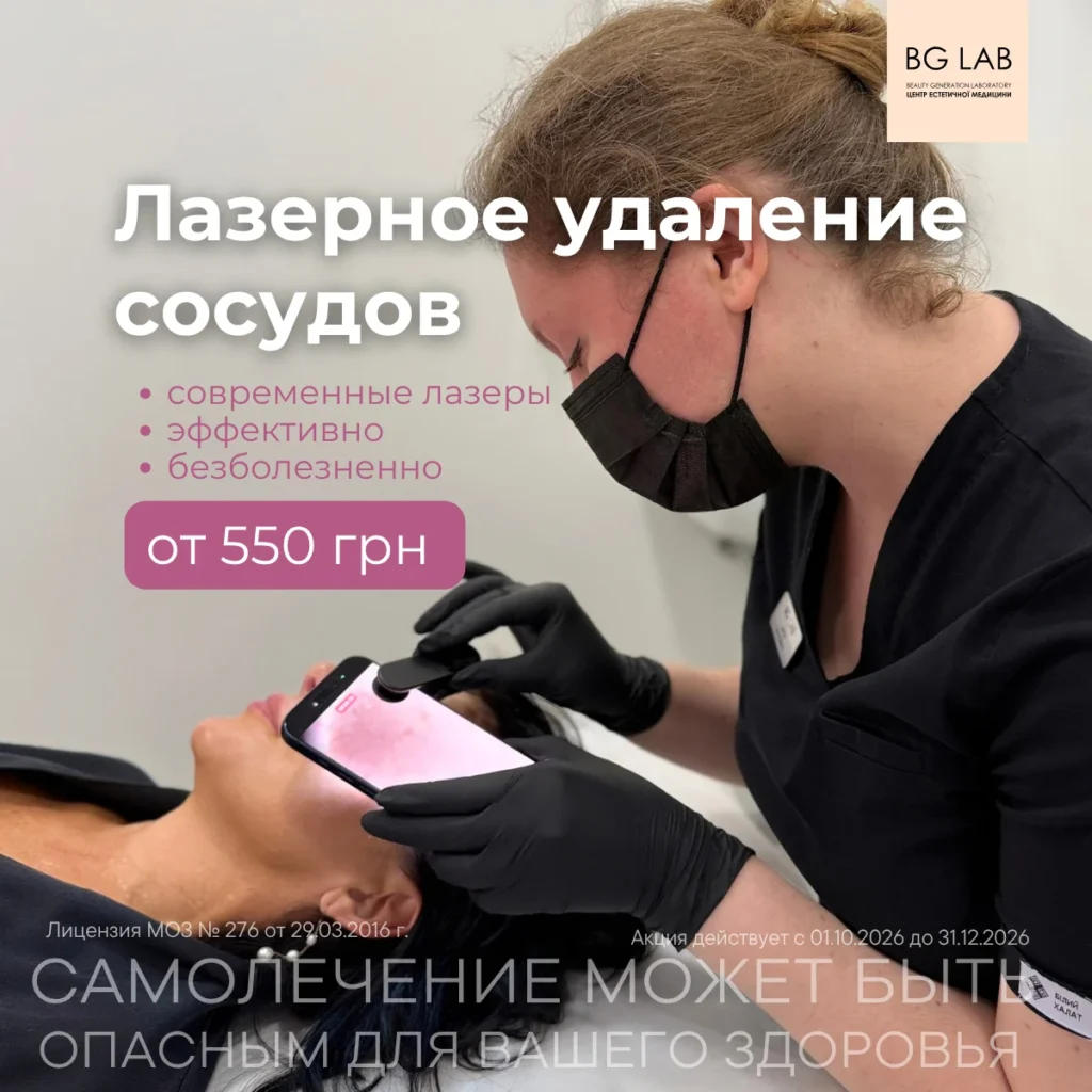Лазерное удаление сосудов от 550 грн