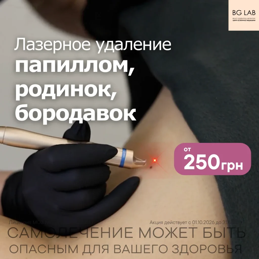 Лазерное удаление папиллом, родинок, бородавок от 250 грн
